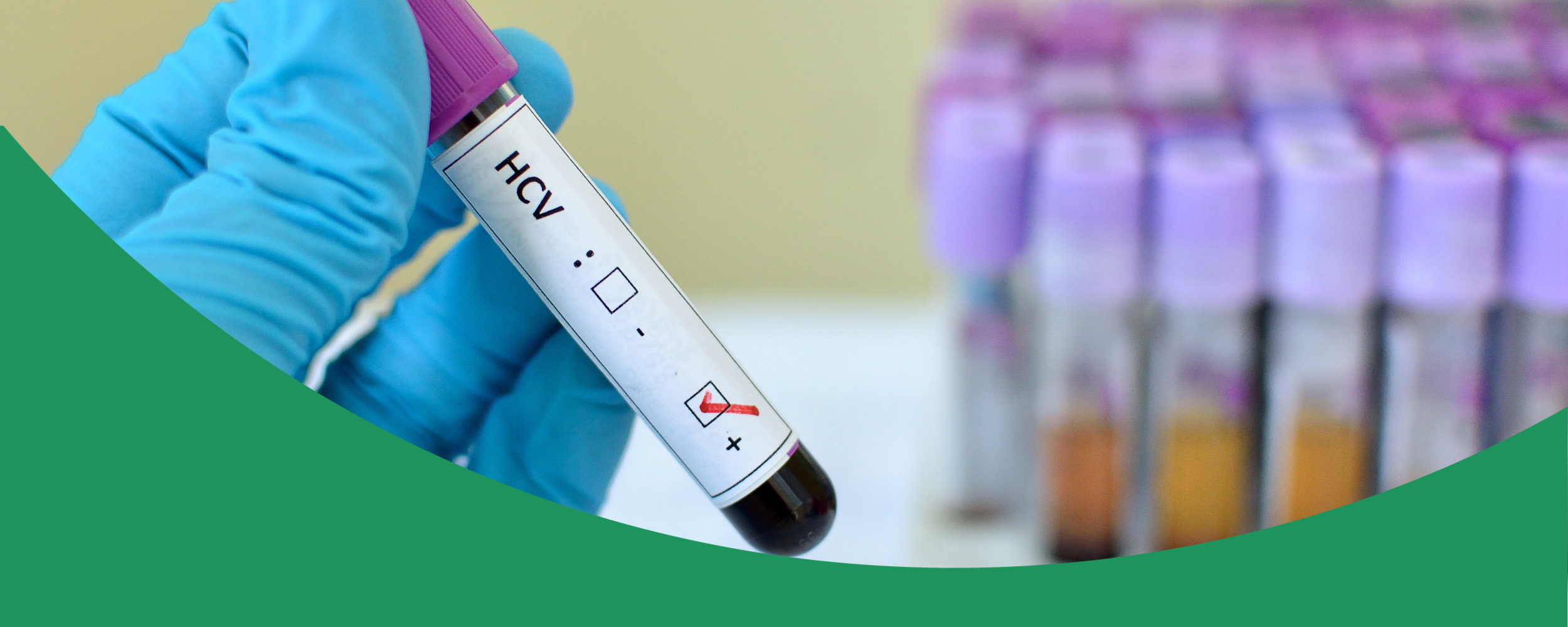 New: Hepatitis C Screening and Care EMR Toolkit for TELUS PS Suite